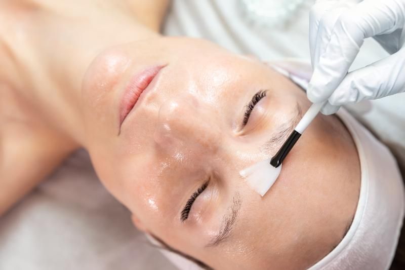 A gloved hand uses a small applicator to spread a clear solution across the face of a reclining client.