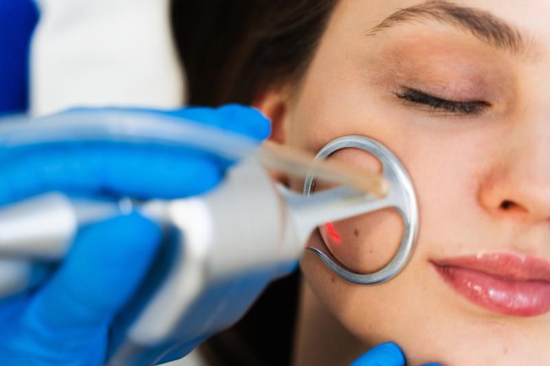 Close view of a handheld treatment device held against a woman’s cheek while her eyes are closed.