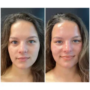 Two side-by-side portrait photographs of the same woman