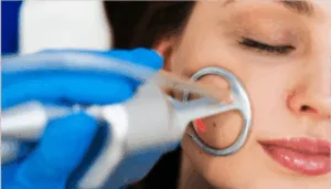 A woman undergoing a skin resurfacing procedure with a laser device on her cheek.